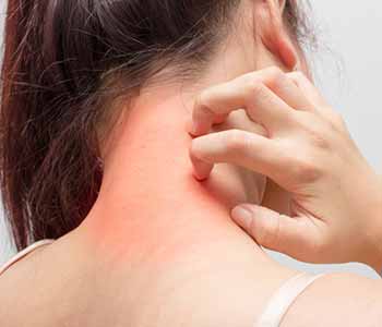 Eczema is a general term for several types of chronic skin rashes that can occur in individuals of all ages.