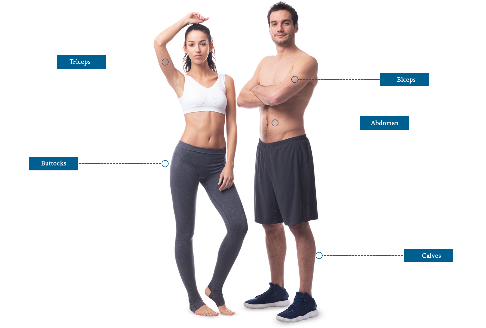 Emsculpt Treatable Areas