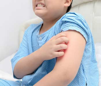 Dermatologist for Kids near Carpentersville area Image 2