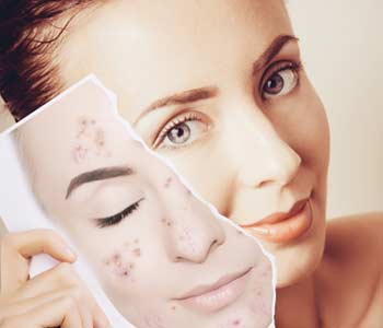 young woman face portrait with photo of her old skin