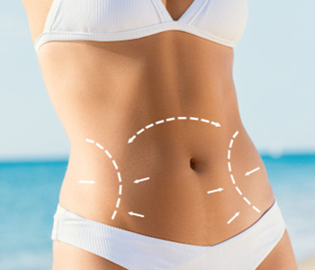 How CoolSculpting Works