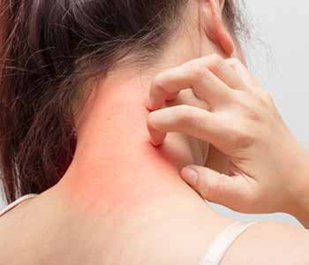 Both adults and children with mild to moderate psoriasis are good candidates for Xtrac laser therapy